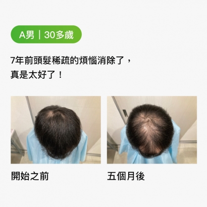 A男｜30多歲