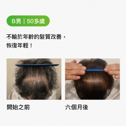 B男｜50多歲