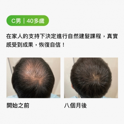 C男｜40多歲