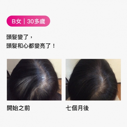 B女｜30多歲