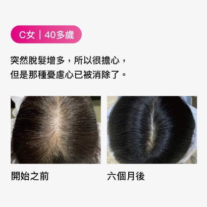 C女｜40多歲