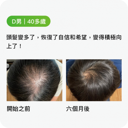 D男｜40多歲